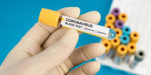 В Ізраїлі розробили 10-секундний тест на COVID-19, незабаром він може з’явитися в Україні